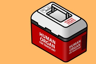 organ-transplant_770