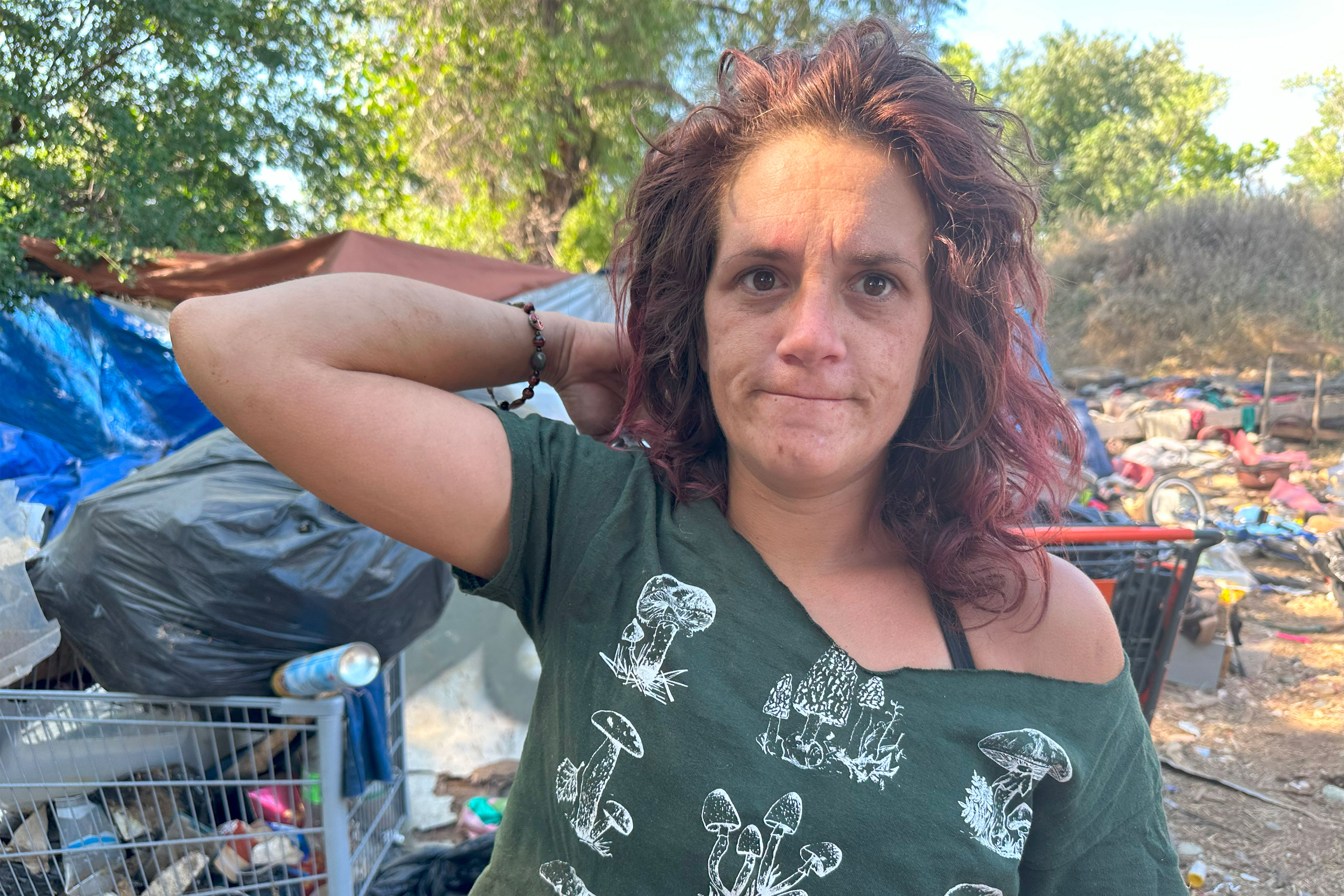 A woman looks at the camera and lifts her bent arm to show the camera. There are tents, shopping carts, and trash behind her.